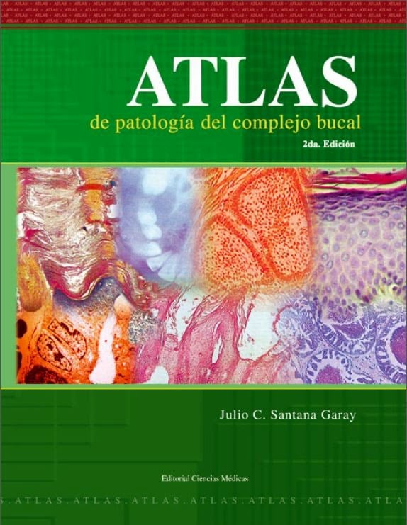 Atlas de Patología del Complejo Bucal 2 Edición Julio C. Santana Garay PDF