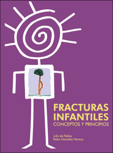 Fracturas Infantiles: Conceptos y Principios 1 Edición Julio De Pablos - PDF | Solucionario
