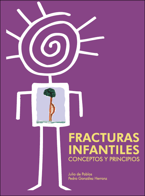 Fracturas Infantiles: Conceptos y Principios 1 Edición Julio De Pablos PDF