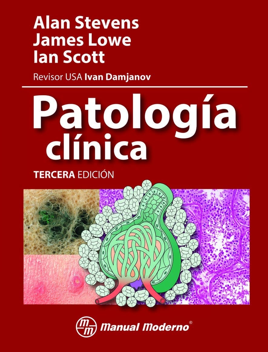 Patología Clínica 3 Edición Alan Stevens PDF